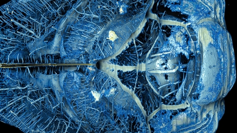 Visualization of segmentation of the vasculature in an entire mouse brain