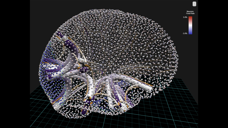 SciVis Contest: Brain Visualization
